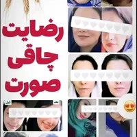 تپلی صورت|آرایشی، بهداشتی، درمانی|رشت, بلوار گیلان|دیوار