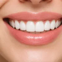 ایمپلنت،لمینت و کامپوزیت قیمت مناسب،کیفیت تضمین
