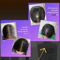 محلول گیاهی ضد ریزش مو و رویش مجدد|آرایشی، بهداشتی، درمانی|شیراز, بهارستان|دیوار
