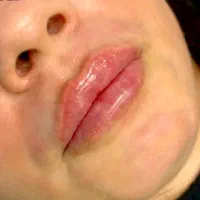 تخفیف شامل خدمات زیبایی و فول فیس لب روسی
