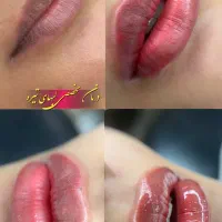 مدل لب کبود|خدمات آرایشگری و زیبایی|گرگان, |دیوار