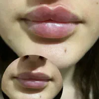 آف ویژه 800 تزریقات وآموزش ژل و بوتاکس پرسینگ|خدمات زیبایی و سلامت|شیراز, لشکری|دیوار