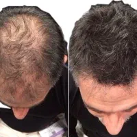 بهترین نتیجه در کمترین زمان