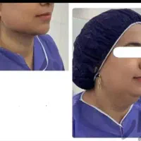 خدمات ژل بوتاکس ساکشن غبغب شکم پهلو تزریق به باسن