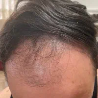 کاشت ابرو وکاشت مو فقط 15 میلیون|خدمات آرایشگری و زیبایی|تربتحیدریه, مسجد جامع|دیوار