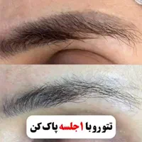 ریمو تتو.کربن ترابی صورت.روشنکردن نواحی تیره|خدمات آرایشگری و زیبایی|قم, باجک دو|دیوار