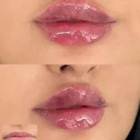 مرکز زیبایی بوتاکس و فیلر و تمامی خدمات زیبایی|خدمات آرایشگری و زیبایی|اصفهان, ملکشهر|دیوار