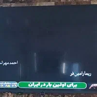 تلویزیون ۶۵ اینچ دوو اسپیکر دار