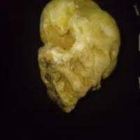 سنگ قیمتی شبیه اسکلت سر ادم وبسیار کمیاب