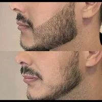 کاشت ممنوع شد
