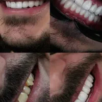 خدمات دندانپزشکی