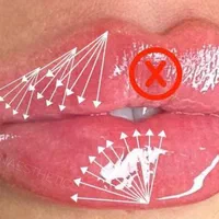 کلینیک تزریق ژل لبM 390بوتاکس لیزر لیفت متدMDCode|خدمات آرایشگری و زیبایی|تهران, صادقیه|دیوار