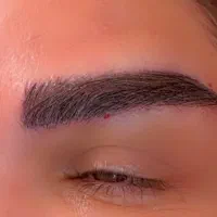 کاشت ابرو - میکروکاشت