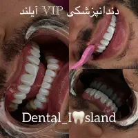 50%تخفیف استثنایی+ اقساط بلند مدت بدون‌ سود