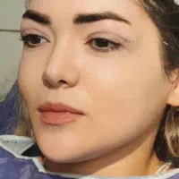 بلفاروپلاستی ،سانترال،دایرکت ابرو،کاشت vipجشنواره|خدمات آرایشگری و زیبایی|تهران, تجریش|دیوار