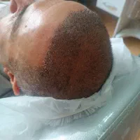 کاشت سر  و خدمات زیبایی