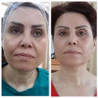 دوست داری از همیشه زیبا تر باشی بیاسالن دلا|خدمات آرایشگری و زیبایی|کرج, باغستان|دیوار