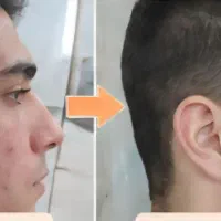پوست شفاف و جوان با کرم بیوممتیک تحویل یک‌روزه