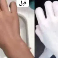 کرم روشن کننده خارجی مکمل چاقی صورت تضمینی|آرایشی، بهداشتی، درمانی|بندر ماهشهر, |دیوار