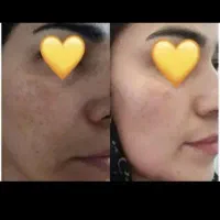 کرم ضدلک وروشن کننده|آرایشی، بهداشتی، درمانی|اهواز, فاز ۱ پادادشهر|دیوار