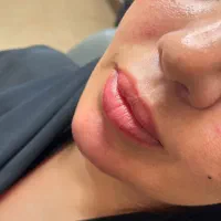 جشنواره پاییزه تزریق ژل و بوتاکس|خدمات آرایشگری و زیبایی|اصفهان, رزمندگان|دیوار