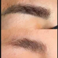 ریموو تاتو تک جلسه ای