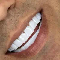 جشنواره کامپوزیت