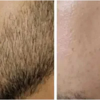 ریشو شو|خدمات آرایشگری و زیبایی|شیراز, شهرک مطهری|دیوار