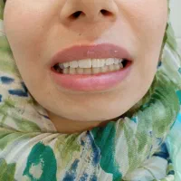 لابراتوار دندانسازی ایمپلنت تخصصی|خدمات آرایشگری و زیبایی|تهران, توحید|دیوار