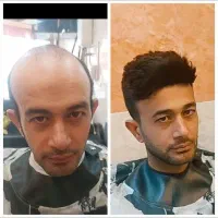 خدمات پروتز و ترمیم مو/پروتز دائم/پروتز مو|خدمات آرایشگری و زیبایی|اصفهان, باغ زیار|دیوار