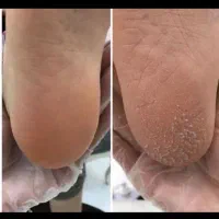 پدیکور و کفسابی با گارانتی|خدمات آرایشگری و زیبایی|اصفهان, سعادت‌آباد|دیوار