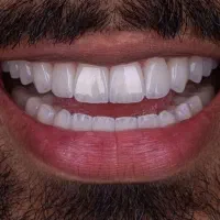 بالاترین کیفیت وارزانترین قیمت خدمات دندانپزشکی|خدمات آرایشگری و زیبایی|شیراز, سینما سعدی|دیوار