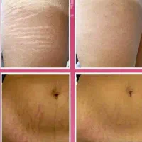 خداحافظی دائمی باترک‌های پوستی بامتد جدیدStria Max