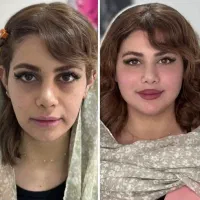 بوتاکس ۷۹۹ تومن تخفیف استثنایی افتتاح مطب