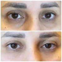 ژل لب مادلینگ کانتورینگ بوتاکس فیلرزیرچشم فیلربادی|خدمات آرایشگری و زیبایی|تهران, سید خندان (جلفا)|دیوار