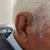 تجویز سمعک‌ فراهوشمند شارژی|پزشکی|تهران, نیاوران|دیوار