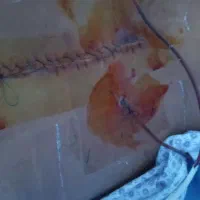 خدمات پرستاری در منزل