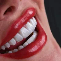 اقساط یک سال بدون پیش پرداخت خدمات دندانپزشکی