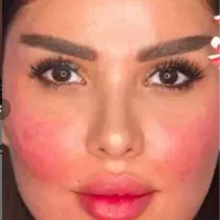 تخفیف ژل و فیلر فول فیس 3900 به جای ۷/۹۰۰|خدمات آرایشگری و زیبایی|اصفهان, خانه اصفهان|دیوار