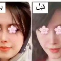 چاقی صورت و بدن تضمینی|خوردنی و آشامیدنی|طبس, |دیوار