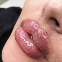 ژل لب و مدلینگ چهره با فرم دهی طبیعی