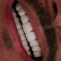 دندانپزشکی،ایمپلنت دندان،اوردنچر،عصب کشی،ارتودنسی