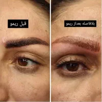 ارایش دائم صورت جشنواره تخفیفات استثنایی فقط ۱هفته|خدمات آرایشگری و زیبایی|مشهد, هفت تیر (حافظ)|دیوار