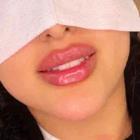 نیازمندمدل تزریق فیلر چانه،لب،زاویه، گونه کات|خدمات آرایشگری و زیبایی|تهران, صد دستگاه|دیوار