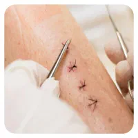 ارائه کلیه خدمات پرستاری و سرم تراپی|خدمات آرایشگری و زیبایی|ارومیه, |دیوار