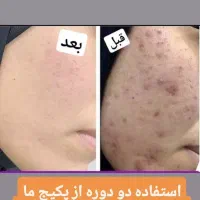 قویترین ضد لک در ایران|آرایشی، بهداشتی، درمانی|بوشهر, |دیوار