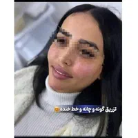 جشنواره ژل و بوتاکس|خدمات آرایشگری و زیبایی|تهران, هفت حوض|دیوار