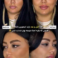 نیاز فوری به مانکن جهت تزریق بوتاکس و فیلر لب|خدمات آرایشگری و زیبایی|تهران, امانیه|دیوار