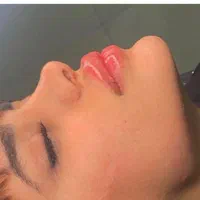 ژل لب ۶۵۰بوتاکس آنزیم لب زاویه فک گونه کانتورینگ|خدمات آرایشگری و زیبایی|شیراز, منطقه هوایی شهید دوران|دیوار