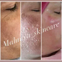 پاکسازی و فیشیال(فیشال)،آلگاپیل،تکنیک پوست کره‌ای